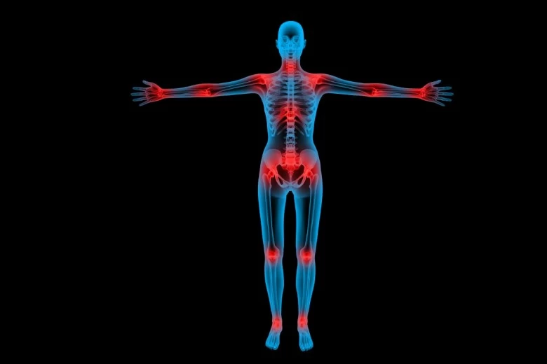 Bolesti mišića, kostiju i vezivnog tkiva
