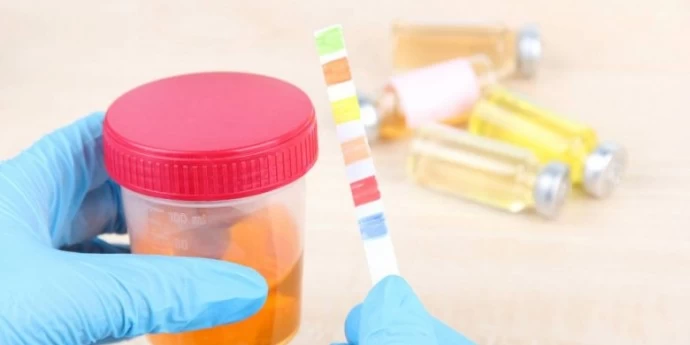 Urinarna infekcija – simptomi i lečenje